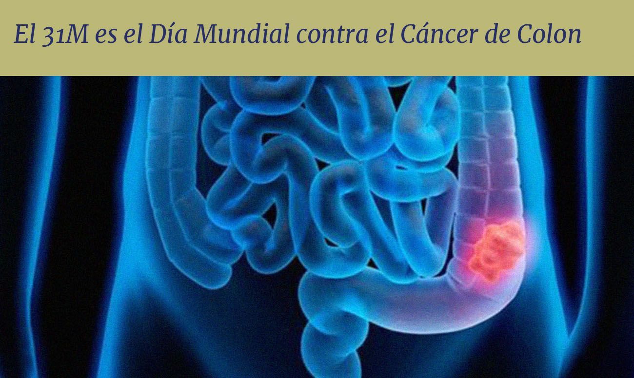 El 31 de marzo es el Día Mundial contra el Cáncer de Colon
